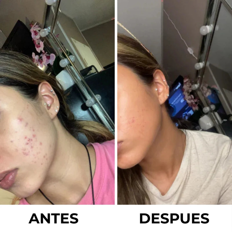Antes y después