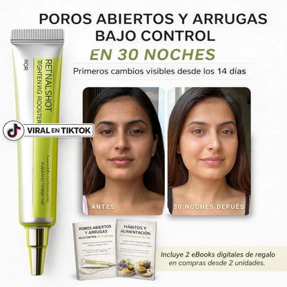 Retinal Shot – La fórmula nocturna para arrugas y poros marcados
