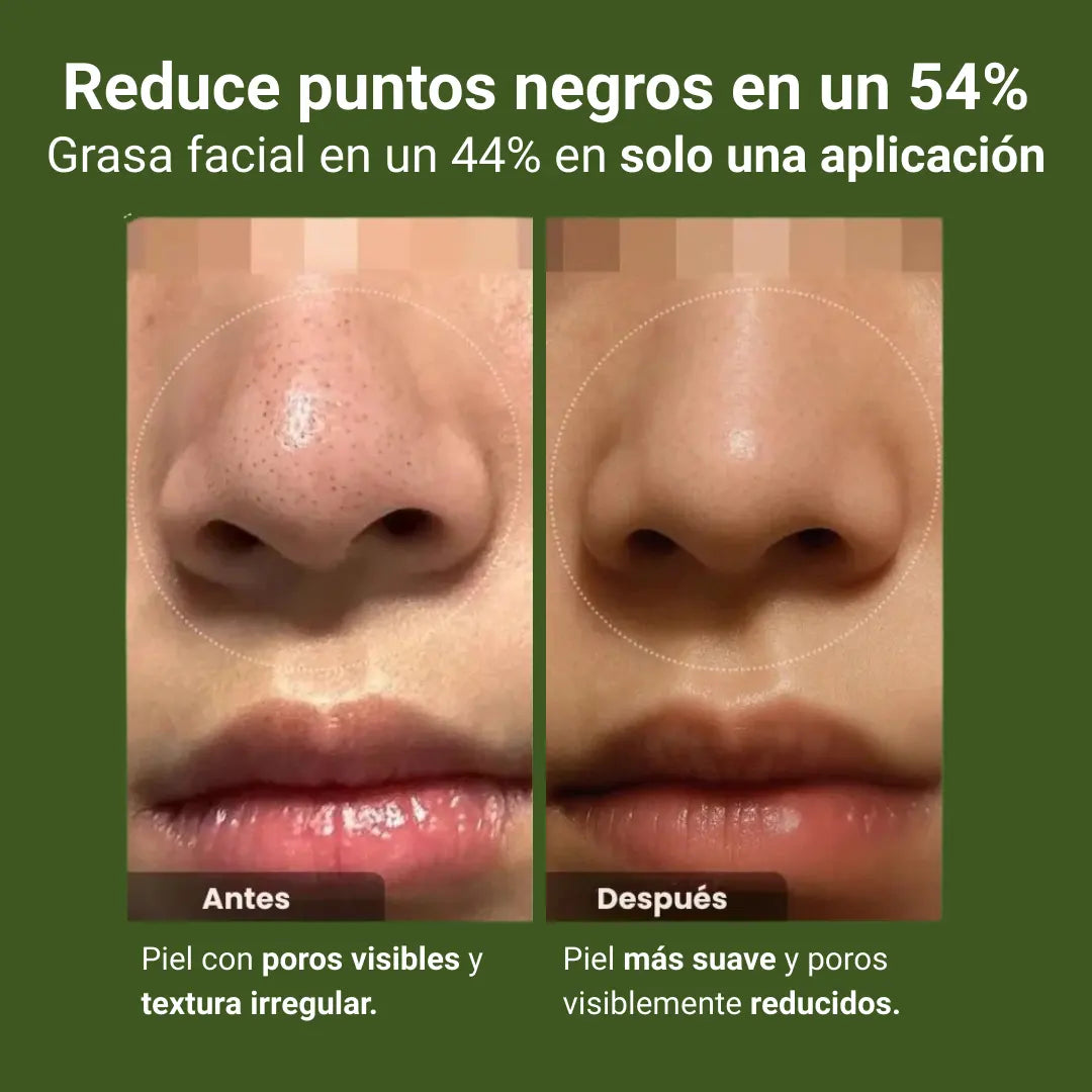 Mascarilla coreana para puntos negros — sin irritar piel sensible
