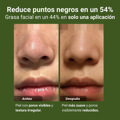 Mascarilla coreana para puntos negros — sin irritar piel sensible