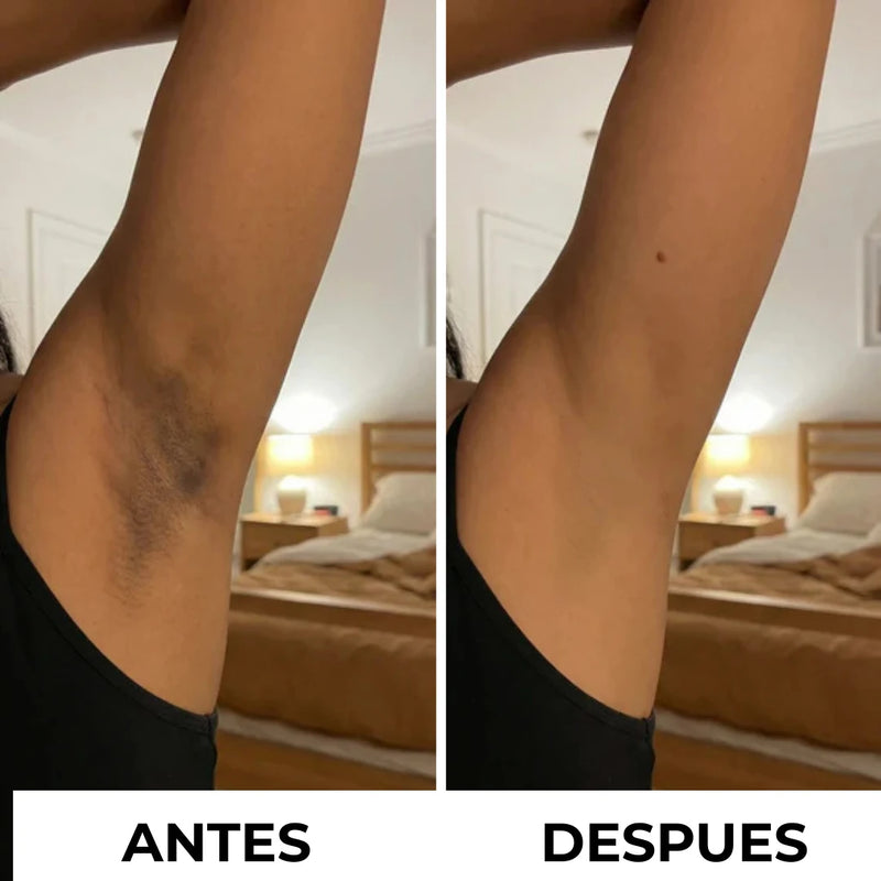Antes y después