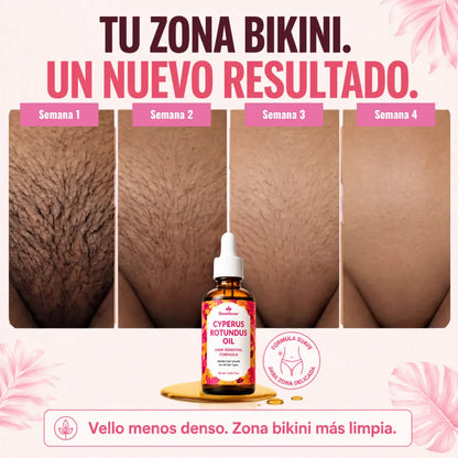 SlowGrow™ — Aceite Para Reducir el Vello