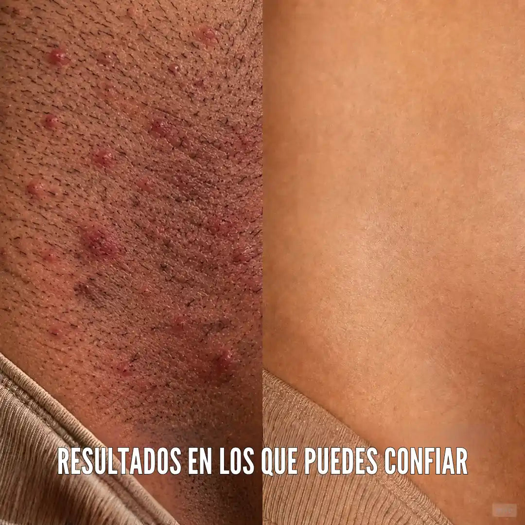 SlowGrow™ — Aceite Para Reducir el Vello