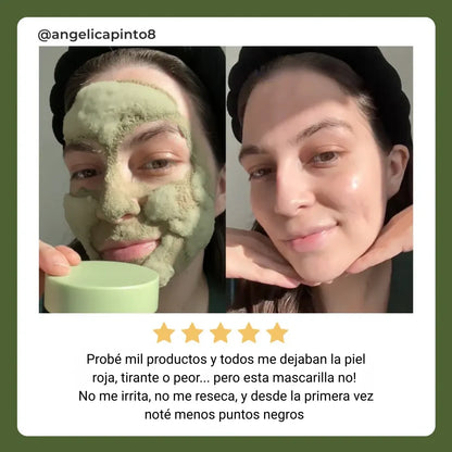Mascarilla coreana para puntos negros — sin irritar piel sensible