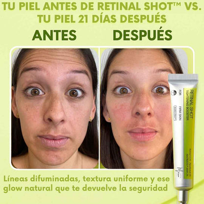 Retinal Shot™ - La solución express contra líneas de expresión